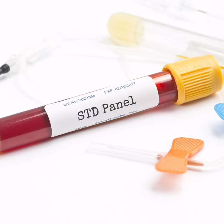 Blood sample tube labeled STD Panel with a yellow cap on a white lab surface.