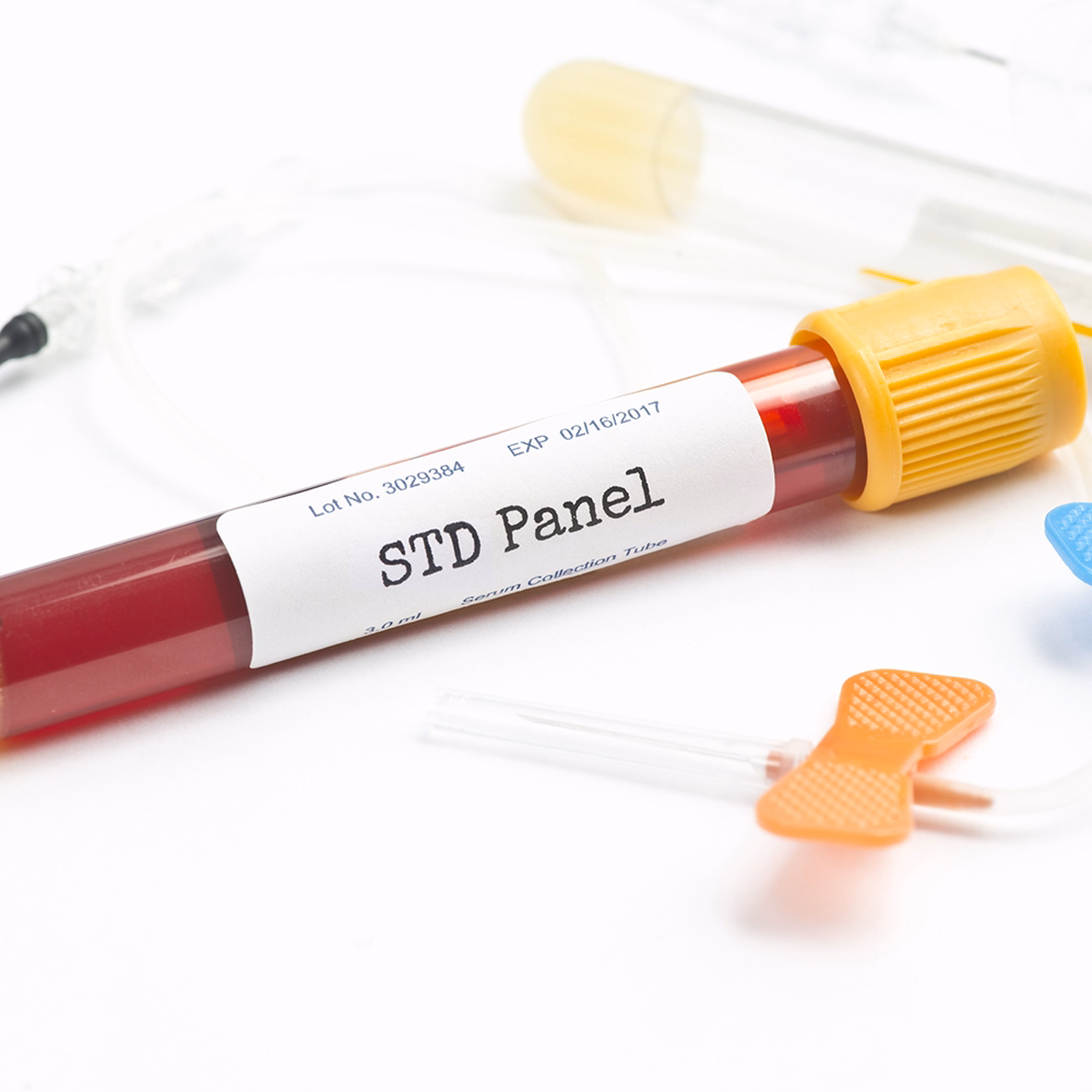 Blood sample tube labeled STD Panel with a yellow cap on a white lab surface.