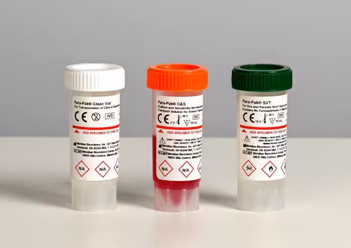 Three medical specimen vials with white, orange, and green caps on a white surface; labels show hazard symbols and handling instructions for clinical samples.