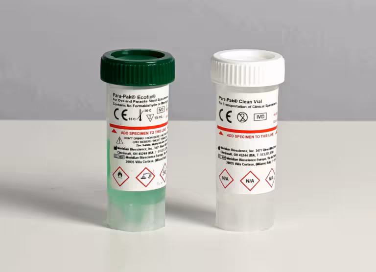 Two clinical specimen vials with green and white caps on a white surface, labels showing warning symbols and text against a gray background.