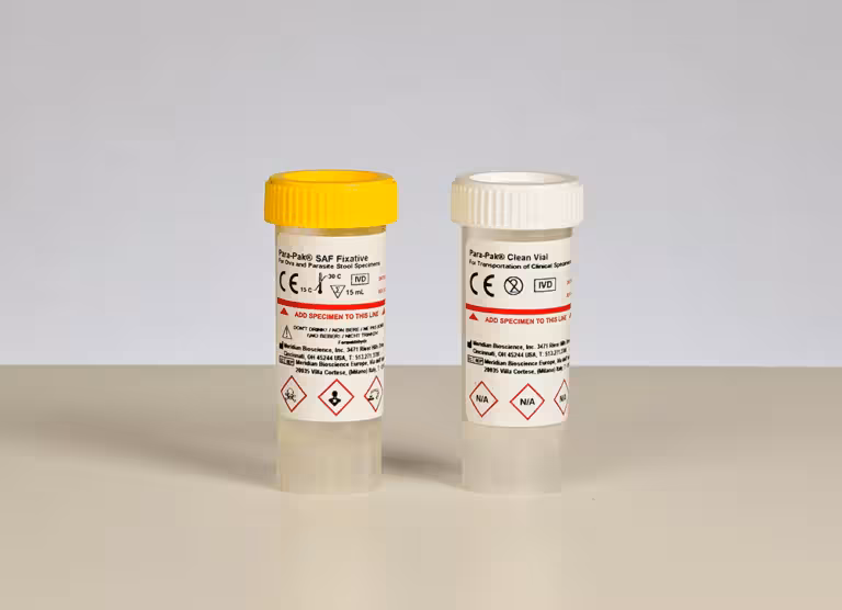 Two medical specimen vials with colored caps (one yellow, one white) on a neutral surface, labels show hazard symbols and handling instructions.