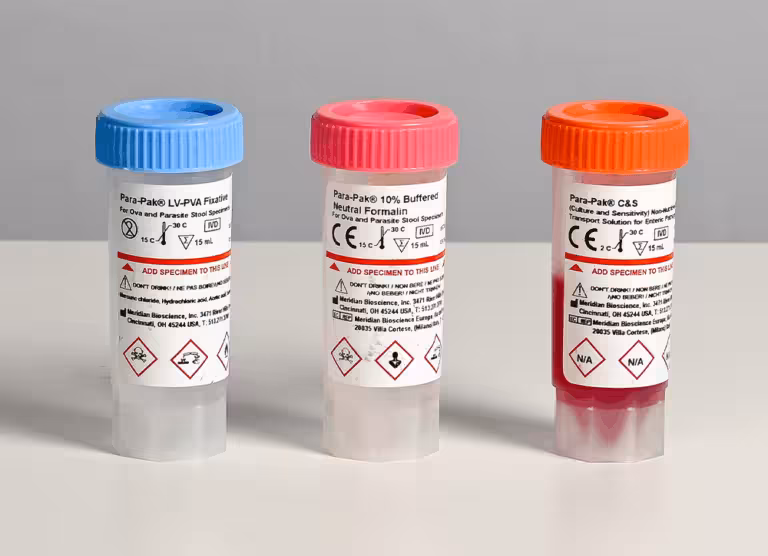 Three specimen bottles with blue, pink, and orange caps on a white surface; labels show hazard symbols and preservation instructions.