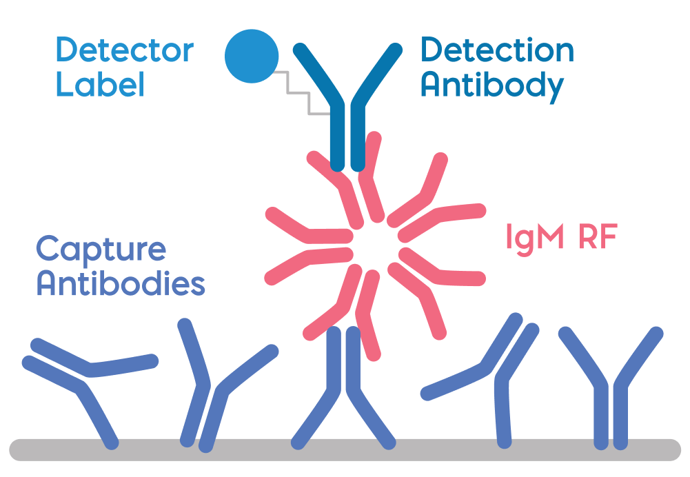 IgM Rheumatoid Factor (RF) Interference